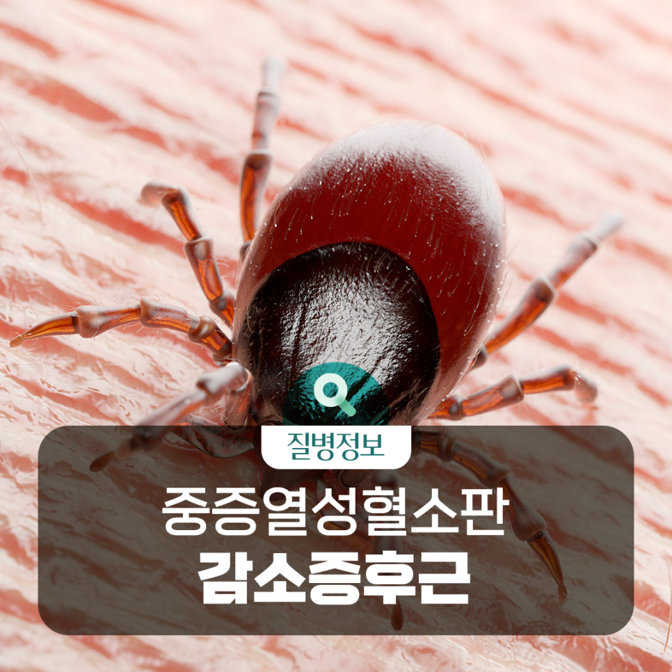 대구광역시 감염병관리지원단 배너